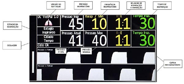 DL720 - Aparelho de Ventilação Mecânica para Anestesia Inalatória - Veterinário - Imagem 4